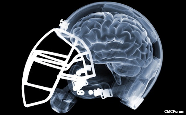 Legislation aims to curb concussions through education – St. Petersburg Times