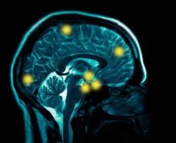 New Study Links Athletes’ Repetitive Head Injuries to Degenerative Brain Disease