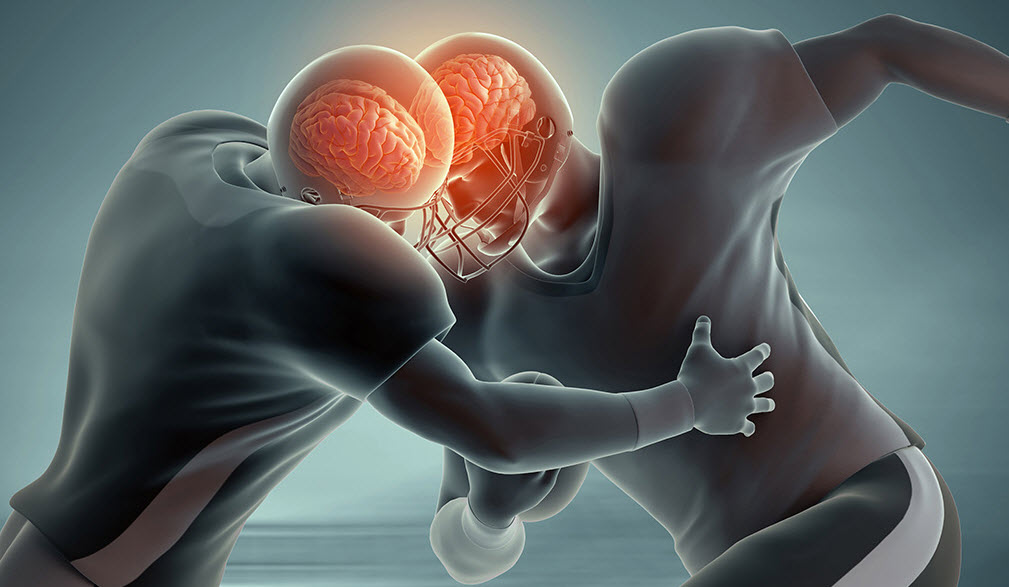 A new way of looking at concussions